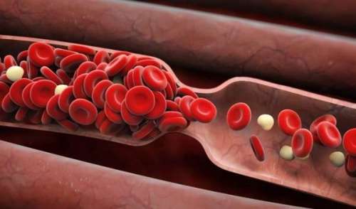 علائم لخته شدن خون در بدن چیست؟