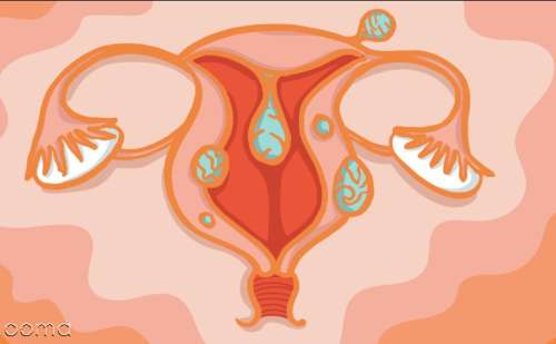 فیبروم در بارداری چقدر خطرناک است؟