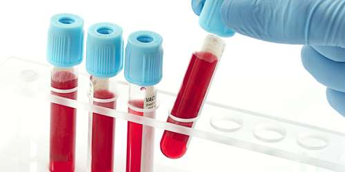 بیشتر  اهداکنندگان خون  از گروه‌های خونی منفی هستند یا مثبت؟