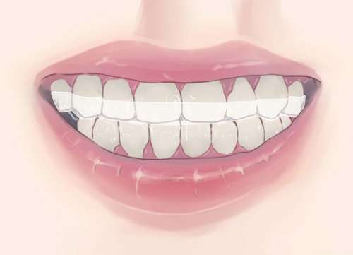 دندان قروچه یا ساییدن چه دلایلی دارد؟ مراقب مفصل‌ها باشید