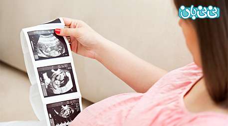 انواع سونوگرافی در بارداری